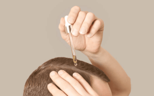 Pessoa fazendo a aplicação de minoxidil no couro cabeludo