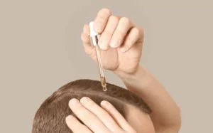 Pessoa fazendo a aplicação de minoxidil no couro cabeludo