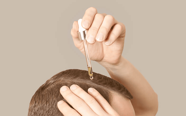Pessoa fazendo a aplicação de minoxidil no couro cabeludo