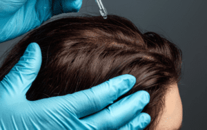 Pessoa descobrindo qual o melhor minoxidil para cabelo feminino