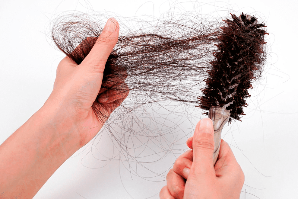 Uma pessoa sem saber o que é bom para queda de cabelo enquanto segura escova