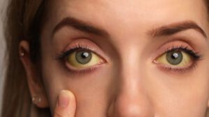 imagem de uma mulher com os olhos amarelos