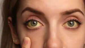 imagem de uma mulher com os olhos amarelos