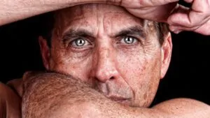 imagem de um homem com manchas no rosto causadas pelas idade