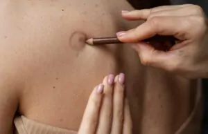 Médica verificando a presença de um furunculo na pele