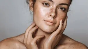 imagem de uma mulher com sardas