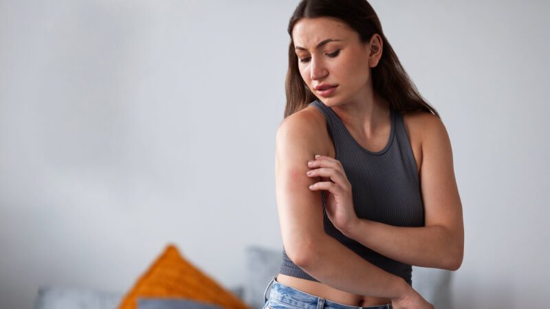 Imagem de uma mulher com alergia no braço