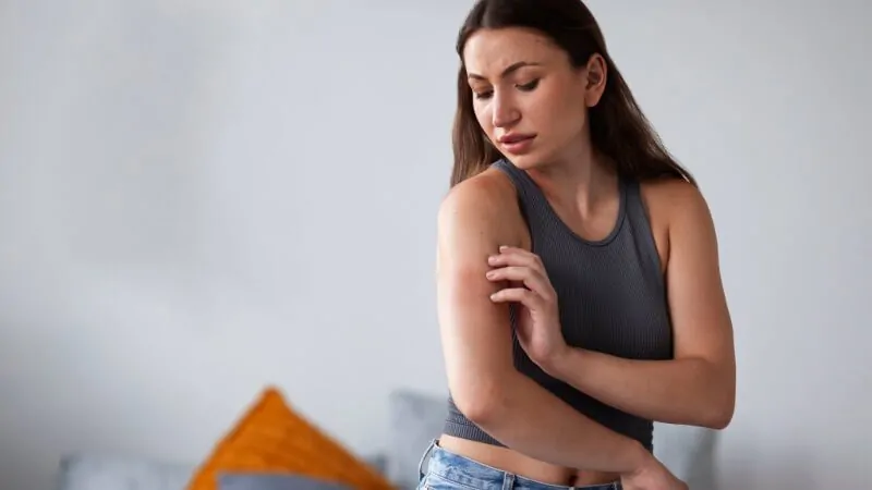 Imagem de uma mulher com alergia no braço