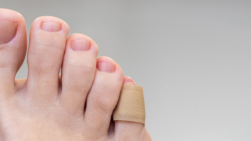 imagem de um pé com um curativo na unha