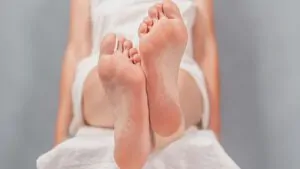 imagem da sola do pé com calos e descascando