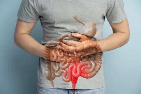 Homem com câncer de intestino