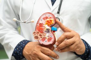 Representação de rim saudável e rim policístico