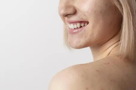 Mulher em busca de sabonete para acne