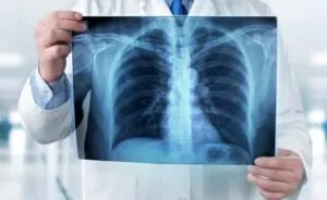 Homem mostrando pulmões com doenças respiratórias