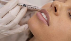 preenchimento com ácido hialurônico